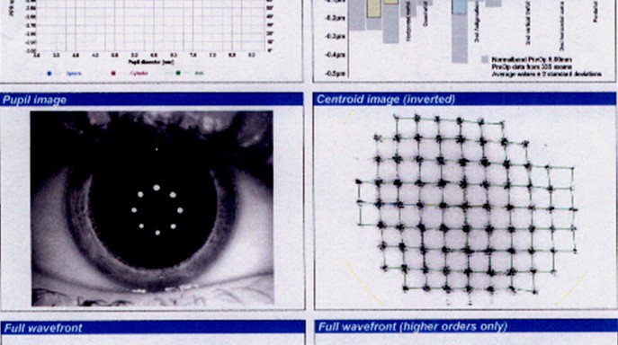 Aberrometria-corneal